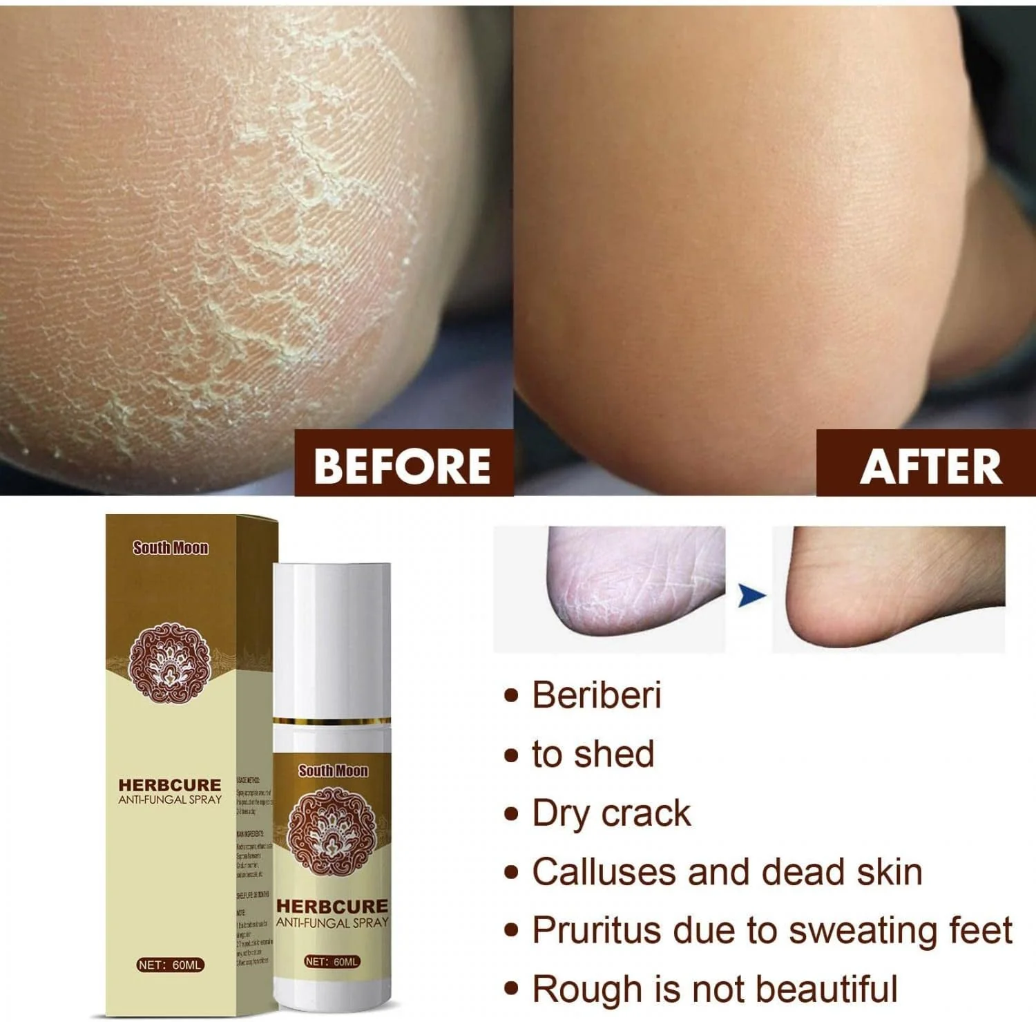 Verfrissende Voetspray - Langdurige Frisheid en Bescherming - Afbeelding 4