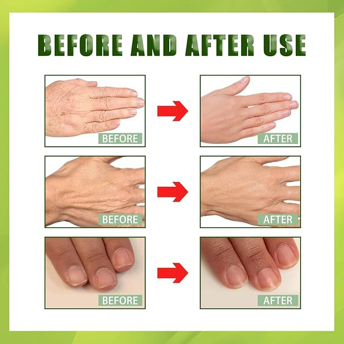 Handmasker – Anti-Rimpel en Herstel - Verzorgt en Verzacht - Afbeelding 7